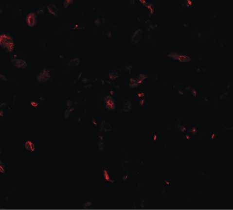 Immunofluorescence of TFEB in human lung tissue with TFEB antibody at 20 ug/ml.