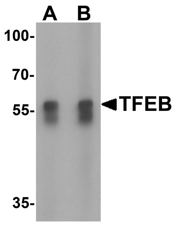 Western blot analysis of TFEB in A549 cell lysate with TFEB antibody at (A) 1 and (B) 2 ug/ml.