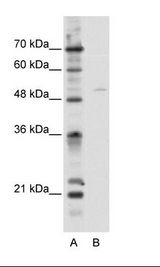 A: Marker, B: HepG2 Cell Lysate