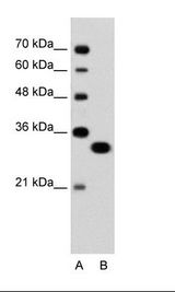 A: Marker, B: Jurkat Cell Lysate