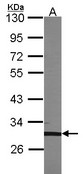Sample (30 ug of whole cell lysate). A:293T. 10% SDS PAGE. TFEC antibody. TFEC antibody diluted at 1:1000.