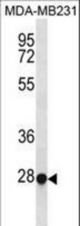 TFEC Antibody western blot of MDA-MB231 cell line lysates (35 ug/lane). The TFEC antibody detected the TFEC protein (arrow).