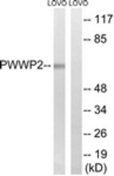 Western blot of extracts from LOVO cells, using PWWP2B Antibody. The lane on the right is treated with the synthesized peptide.