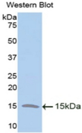 Western blot of recombinant TFF2 / SP.