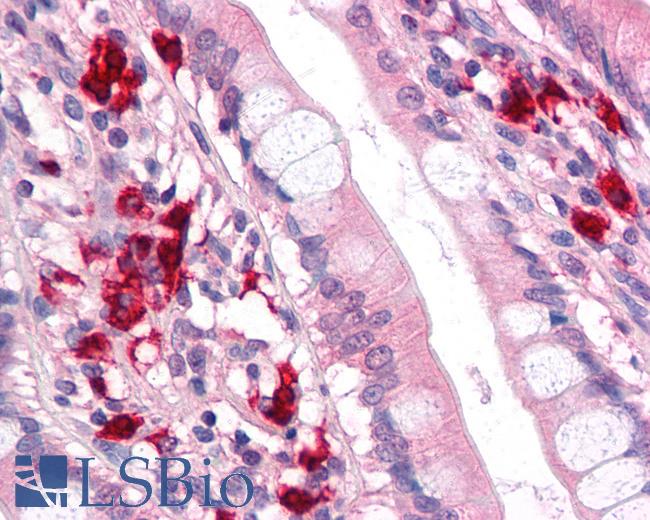 Anti-TFF2 antibody LS-A9841 IHC of human small intestine. Immunohistochemistry of formalin-fixed, paraffin-embedded tissue after heat-induced antigen retrieval.