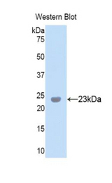 Western blot of recombinant PXDN / MG50.