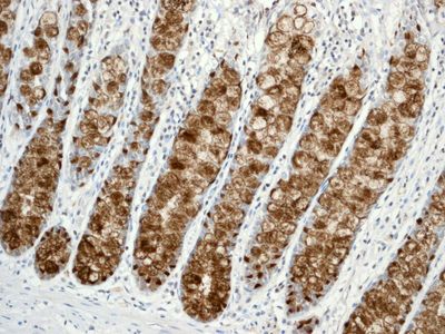 IHC of paraffin-embedded human colon tissue using anti-TFF3 antibody.