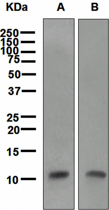 Western blot analysis on (A) uterus cancer and (B) colon cancer lysates using anti-TFF3 antibody.