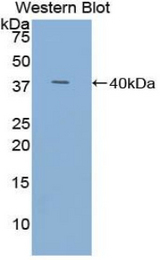 Western blot of recombinant TFF3 / Trefoil Factor 3.