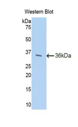 Western blot of recombinant TFF3 / Trefoil Factor 3.