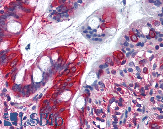 Anti-TFG antibody IHC of human small intestine. Immunohistochemistry of formalin-fixed, paraffin-embedded tissue after heat-induced antigen retrieval. Antibody LS-B1784 concentration 10 ug/ml.