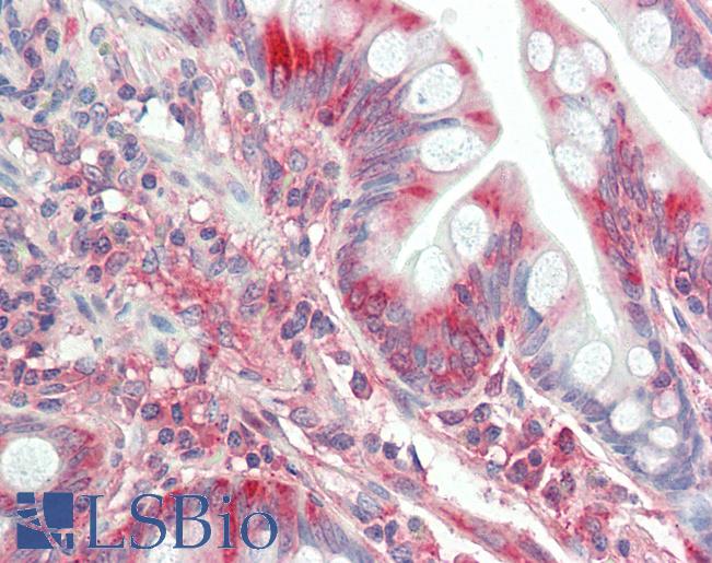 Anti-TFG antibody IHC staining of human small intestine. Immunohistochemistry of formalin-fixed, paraffin-embedded tissue after heat-induced antigen retrieval. Antibody LS-B11074 concentration 5 ug/ml.
