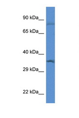 GTF2B / TFIIB antibody LS-C145285 Western blot of Rat Lung lysate. Antibody concentration 1 ug/ml.