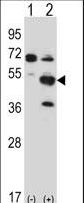 Western blot of Pxk (arrow) using rabbit polyclonal Mouse Pxk Antibody. 293 cell lysates (2 ug/lane) either nontransfected (Lane 1) or transiently transfected (Lane 2) with the Pxk gene.