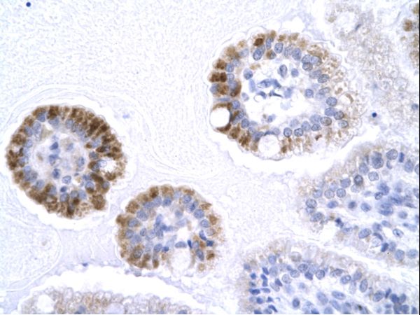GTF2B / TFIIB antibody LS-C30756 was used in IHC to stain formalin-fixed, paraffin-embedded human intestine.