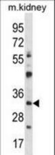 GTF2B Antibody western blot of mouse kidney tissue lysates (35 ug/lane). The GTF2B antibody detected the GTF2B protein (arrow).