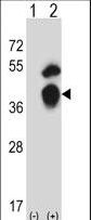 Western blot of GTF2B (arrow) using rabbit polyclonal GTF2B Antibody. 293 cell lysates (2 ug/lane) either nontransfected (Lane 1) or transiently transfected (Lane 2) with the GTF2B gene.