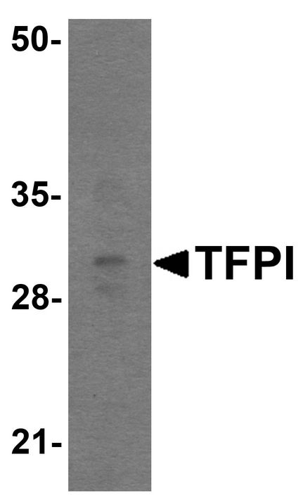 Western blot analysis of TFPI in rat small intestine tissue lysate with TFPI antibody at 1 ug/ml.