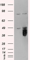 TFPI antibody staining (0.3 ug/ml) of HeLa lysate (RIPA buffer, 35g total protein cells per lane). Primary incubated for 1 hour. Detected by Western blot of chemiluminescence.