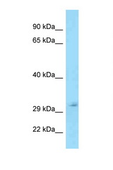 TFPI antibody LS-C145374 Western blot of 721_B Cell lysate. Antibody concentration 1 ug/ml.