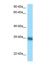 TFPI antibody LS-C146239 Western blot of ACHN Cell lysate. Antibody concentration 1 ug/ml.