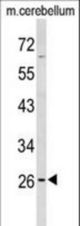 Western blot of PXMP4 Antibody in mouse cerebellum tissue lysates (35 ug/lane). PXMP4 (arrow) was detected using the purified antibody.