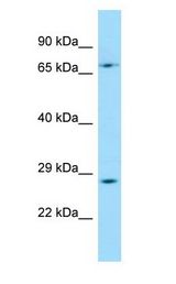 TFPT / Amida antibody Western Blot of HT1080 cell lysate.