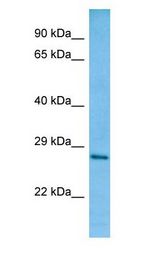 TFPT / Amida antibody Western Blot of Fetal Liver.