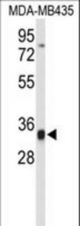 Western blot of TFPT Antibody in MDA-MB435 cell line lysates (35 ug/lane). TFPT (arrow) was detected using the purified antibody.