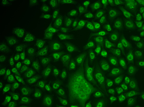 Immunofluorescence analysis of U2OS cell using TFPT antibody.
