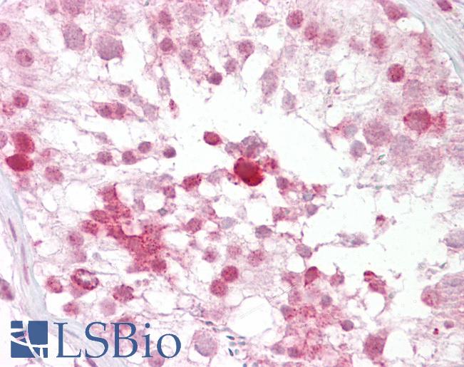 Anti-IFT88 antibody IHC of human testis. Immunohistochemistry of formalin-fixed, paraffin-embedded tissue after heat-induced antigen retrieval. Antibody LS-B6896 concentration 5 ug/ml.
