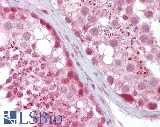 Anti-IFT88 antibody IHC of human testis. Immunohistochemistry of formalin-fixed, paraffin-embedded tissue after heat-induced antigen retrieval. Antibody LS-B6897 concentration 5 ug/ml.