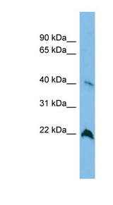 TGDS antibody LS-C116595 Western blot of A549 cell lysate.