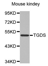 Western blot analysis of extracts of various cell lines, using TGDS antibody.