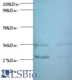 Western blot of transforming growth factor alpha antibody at 2 ug/ml. Lane 1: EC109 whole cell lysate. Lane 2: 293T whole cell lysate. Secondary: Goat polyclonal to Rabbit IgG at 1:15000 dilution. Predicted band size: 18 kDa. Observed band size: 30 kDa Additional bands at: 35 kDa. We are unsure as to the identity of this extra band.