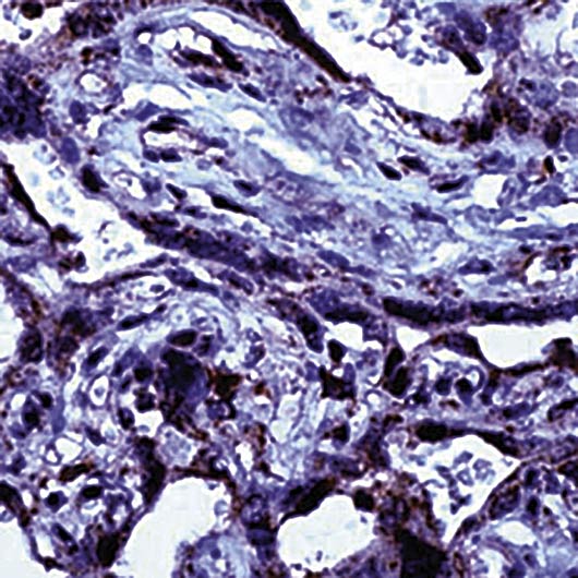 Formalin-fixed, paraffin-embedded human placenta stained with TGF?3 antibody LS-C95978.