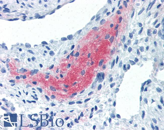 Anti-LEFTY2 antibody IHC of human uterus, myometrium. Immunohistochemistry of formalin-fixed, paraffin-embedded tissue after heat-induced antigen retrieval. Antibody LS-B2540 concentration 10 ug/ml.