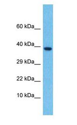 TGFB4 / LEFTY2 antibody Western Blot of Thymus Tumor. Antibody dilution: 1 ug/ml.