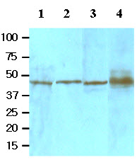 Cell lysates of HeLa, Jurkat, 293T and the extracts of mouse liver tissue(20 ug) were resolved by SDS-PAGE, transferred to NC membrane and probed with anti-human TGFBI (1:1000). Proteins were visualized using a goat anti-mouse secondary antibody conjugated to HRP and an ECL detection system. Lane 1: HeLa; Lane 2: Jurkat; Lane 3:293T; Lane 4: Mouse liver.