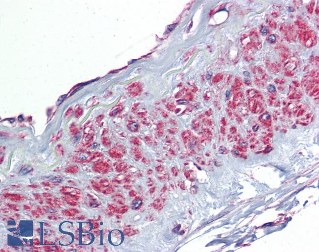 Anti-TGFBI antibody IHC of human vessel. Immunohistochemistry of formalin-fixed, paraffin-embedded tissue after heat-induced antigen retrieval. Antibody LS-B5780 concentration 2.5 ug/ml.