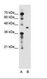 A: Marker, B: Jurkat Cell Lysate.