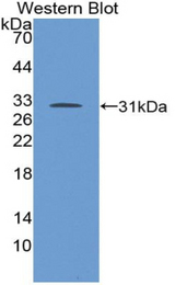 Western blot of recombinant TGFBR1 / ALK5.