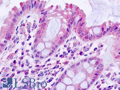 Anti-TGFBR1 / ALK5 antibody IHC staining of human small intestine. Immunohistochemistry of formalin-fixed, paraffin-embedded tissue after heat-induced antigen retrieval.