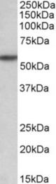 TGFBR1 antibody (0.1 ug/ml) staining of Rat Liver lysate (35 ug protein in RIPA buffer). Primary incubation was 1 hour. Detected by chemiluminescence.
