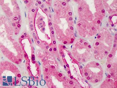 Anti-TGFBR1 antibody IHC of human kidney. Immunohistochemistry of formalin-fixed, paraffin-embedded tissue after heat-induced antigen retrieval. Antibody LS-B1267 concentration 10 ug/ml.