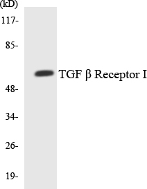 Western blot of the lysates from HeLa cells using TGF beta Receptor I antibody.