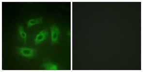 Immunofluorescence of HeLa cells, using TGF beta Receptor I (Ab-165) Antibody. The picture on the right is treated with the synthesized peptide.