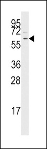 Western blot of anti-TGFBR1 antibody in Jurkat cell line lysates (35 ug/lane). TGFBR1 (arrow) was detected using the purified antibody.