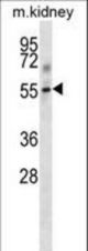 Mouse Tgfbr1 Antibody western blot of mouse kidney tissue lysates (35 ug/lane). The Tgfbr1 antibody detected the Tgfbr1 protein (arrow).