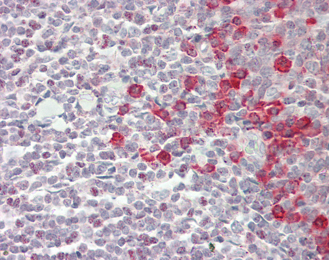 Human Tonsil: Formalin-Fixed, Paraffin-Embedded (FFPE)